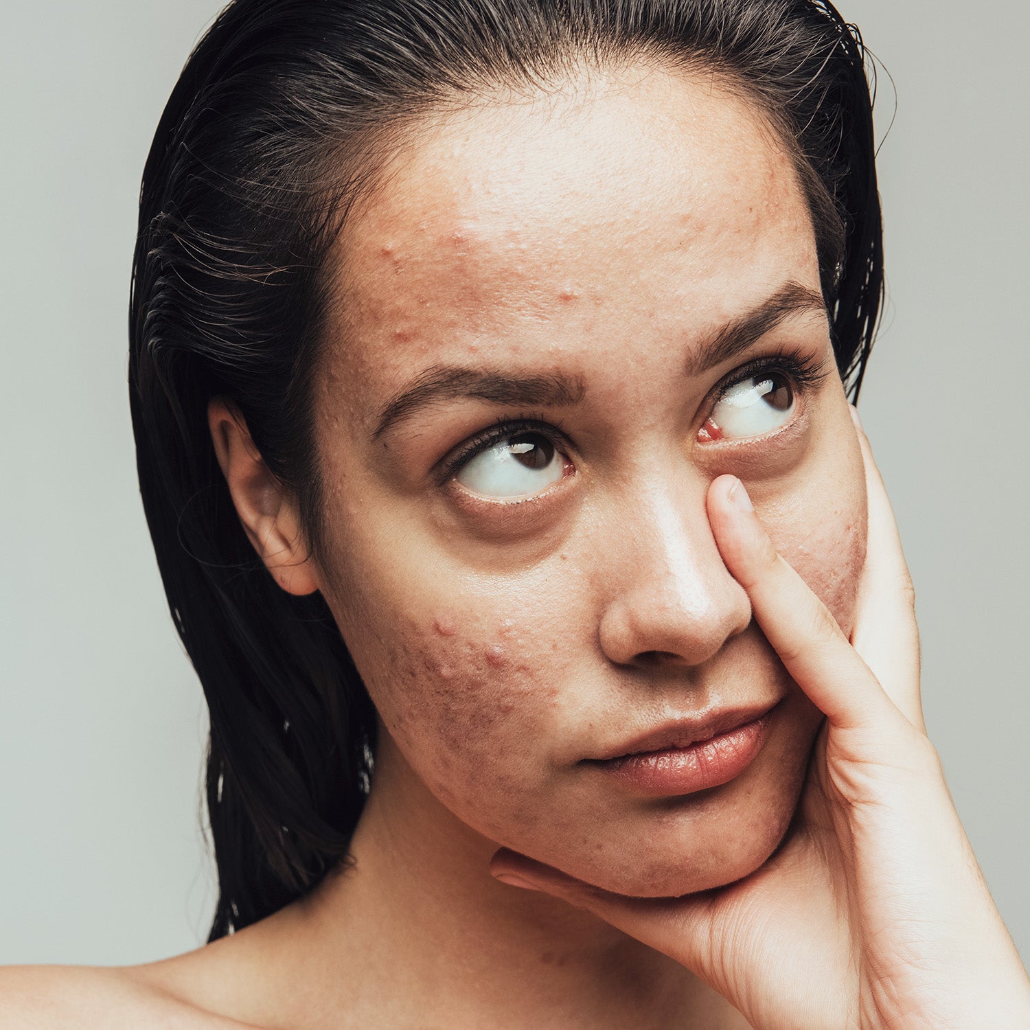 Common Mistakes that Lead to Skin Inflammation